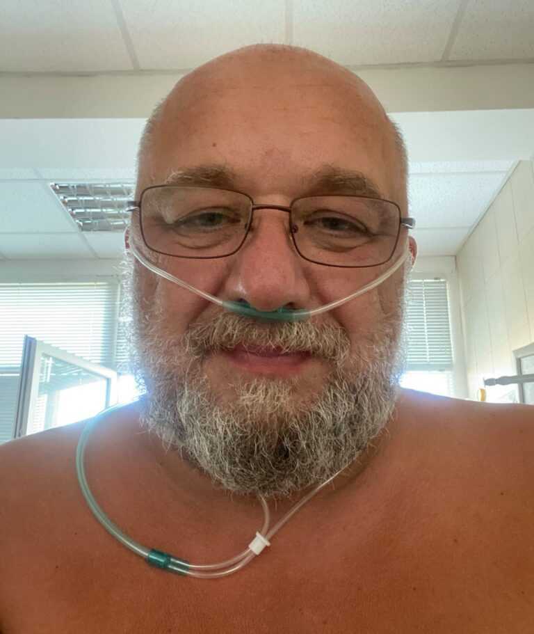 Красен Кралев е бил 12 дни в интензивното във Варна с остра дихателна недостатъчност заради Ковид-19