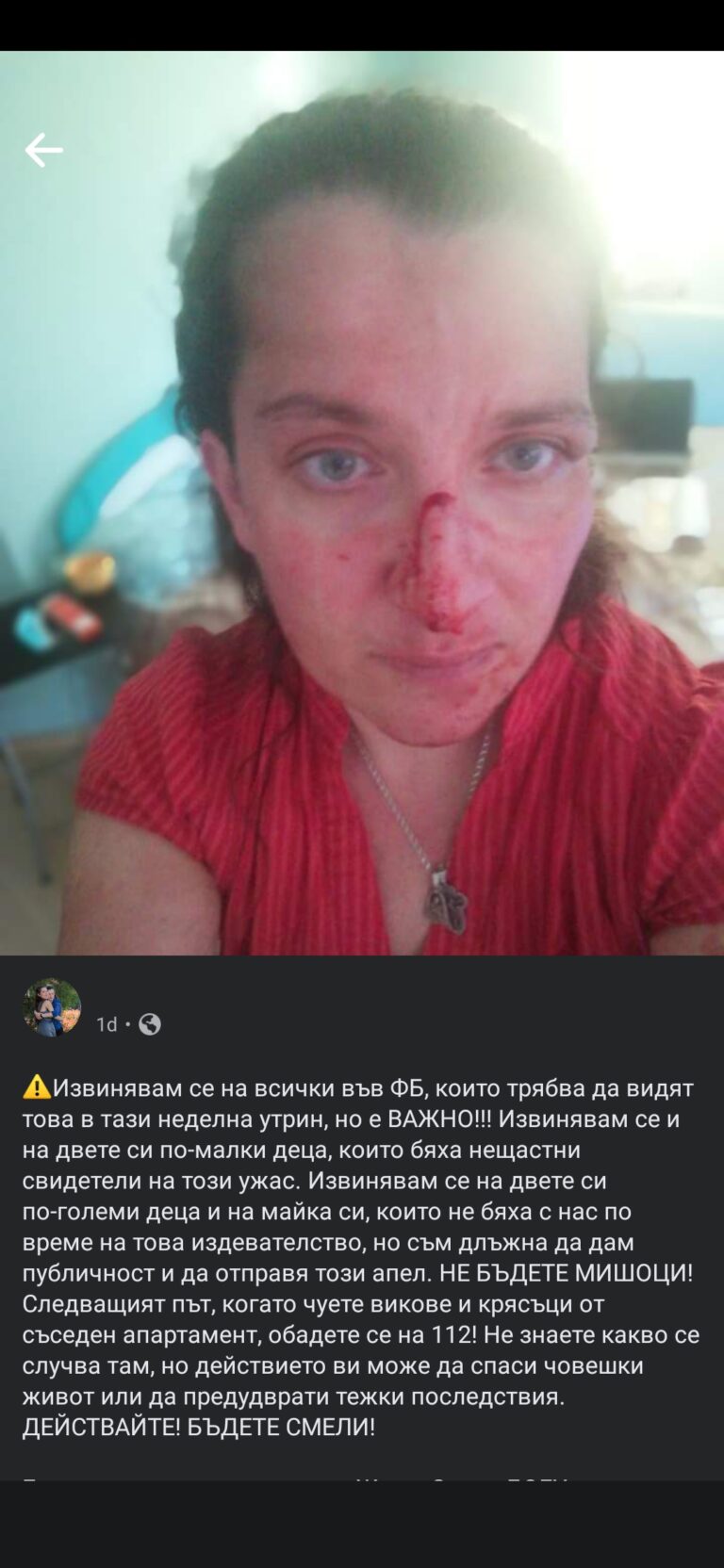 Мъж преби сестра си. Тя си прасна селфи за Фейсбук