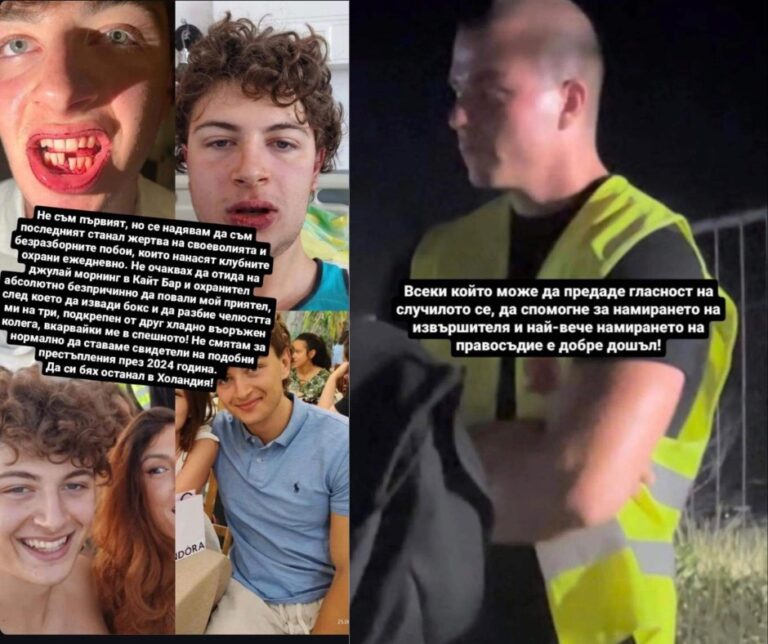 Студент е със счупена челюст след бой от охранител на плажа
